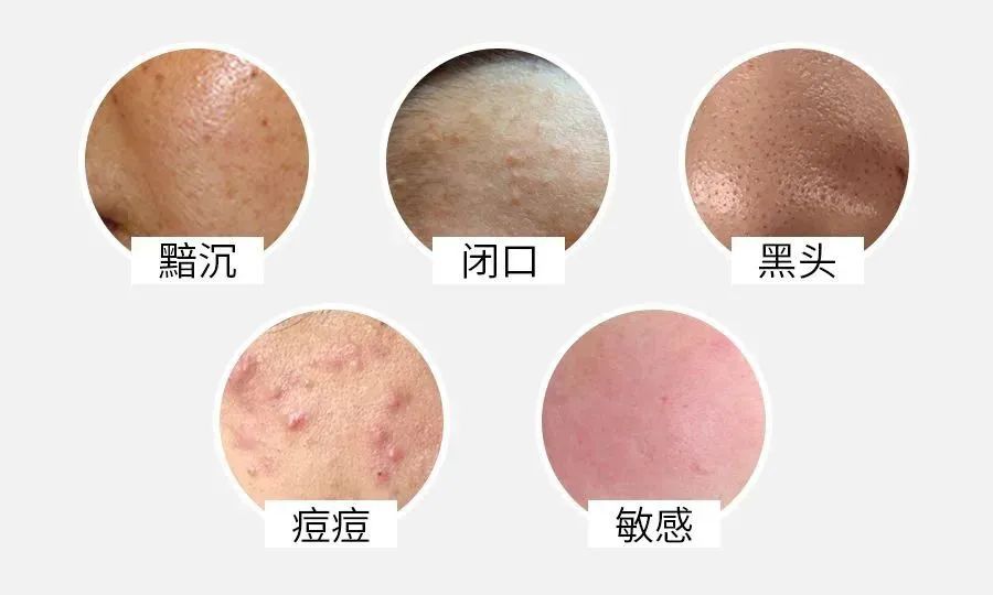 唯美度潔顏乳 | 調(diào)膚絕佳搭檔，洗出嫩滑牛奶肌
